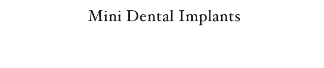                    Mini Dental Implants

    ROSWELL       770-993-6666                      SOUTH ATLANTA      404-768-2615
